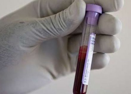 U petak testiranje na HIV